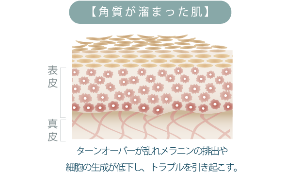 【角質が溜まった肌】