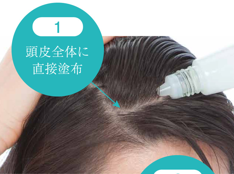 1.頭皮全体に直接塗布