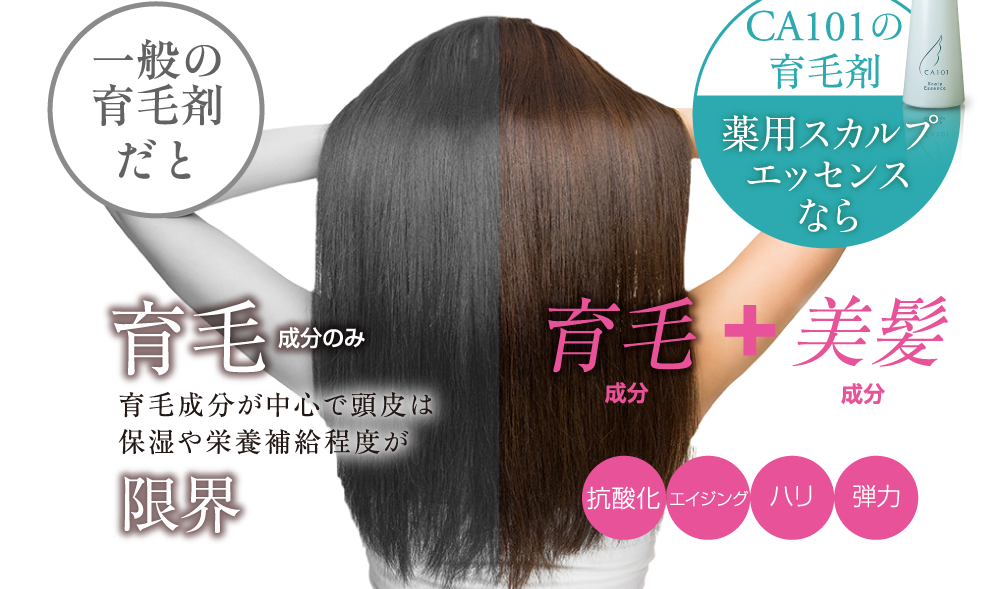 CA101の育毛剤 薬用スカルプエッセンスなら育毛+美髪